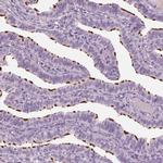 PACRG Polyclonal Antibody