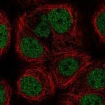 MYST1 Polyclonal Antibody