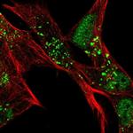 SLC16A6 Polyclonal Antibody