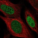 SSPN Polyclonal Antibody