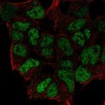 ZNF460 Polyclonal Antibody