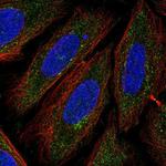 TTPAL Polyclonal Antibody