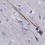 SEMA5B Antibody in Immunohistochemistry (IHC)