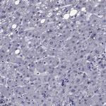 SEMA5B Antibody in Immunohistochemistry (IHC)