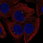 FGF11 Antibody in Immunocytochemistry (ICC/IF)