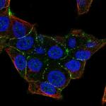 PKP4 Polyclonal Antibody