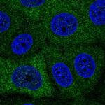 PABPC1L Polyclonal Antibody