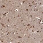 TARSL2 Antibody in Immunohistochemistry (IHC)