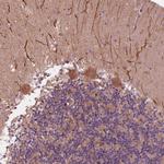 CMIP Antibody in Immunohistochemistry (Paraffin) (IHC (P))