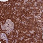 CMIP Polyclonal Antibody