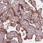 CMIP Antibody in Immunohistochemistry (Paraffin) (IHC (P))