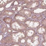 CMIP Antibody in Immunohistochemistry (IHC)