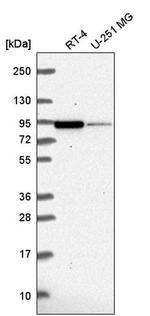 CMIP Antibody in Western Blot (WB)