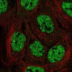 APOBEC3B Polyclonal Antibody