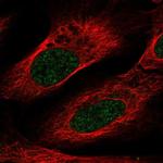 VSIG10L Polyclonal Antibody