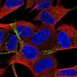 TSPAN11 Polyclonal Antibody