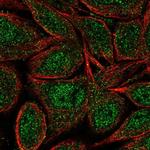 ZNF34 Polyclonal Antibody