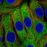 EPPK1 Polyclonal Antibody