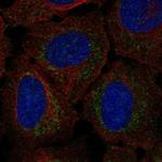 RP11-80H18.3 Polyclonal Antibody