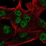 RC74 Polyclonal Antibody