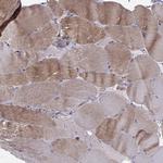 ASB16 Antibody in Immunohistochemistry (IHC)