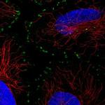 ASB16 Polyclonal Antibody