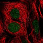 GTF2E1 Antibody in Immunocytochemistry (ICC/IF)