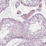 KRT28 Polyclonal Antibody