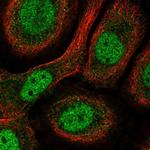 BNC1 Polyclonal Antibody