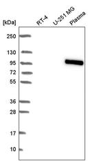 BNC1 Antibody in Western Blot (WB)
