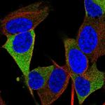 RTL1 Polyclonal Antibody