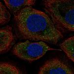 UPF2 Polyclonal Antibody
