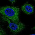 G6PC3 Polyclonal Antibody