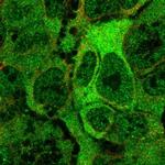 ANKMY2 Polyclonal Antibody