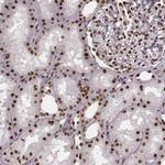 THAP3 Antibody in Immunohistochemistry (IHC)
