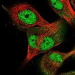 USP24 Polyclonal Antibody