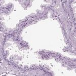 HYDIN Polyclonal Antibody