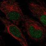 ZNF594 Antibody in Immunocytochemistry (ICC/IF)