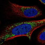 FASTKD2 Polyclonal Antibody