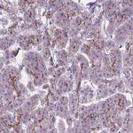 ARMS2 Polyclonal Antibody
