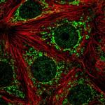 ATP5J2 Polyclonal Antibody