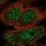 FOXJ3 Polyclonal Antibody