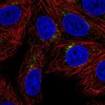 SPPL2A Antibody in Immunocytochemistry (ICC/IF)