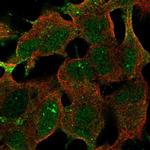 FAM163B Polyclonal Antibody