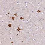 FAM163B Antibody in Immunohistochemistry (IHC)