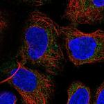 PICK1 Polyclonal Antibody