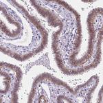 MAN2C1 Antibody in Immunohistochemistry (IHC)
