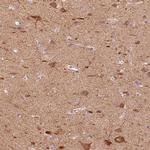 C20orf194 Antibody in Immunohistochemistry (IHC)