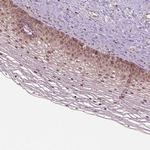 PSMD11 Antibody in Immunohistochemistry (Paraffin) (IHC (P))