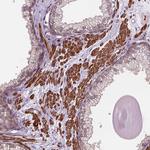 PSMD11 Antibody in Immunohistochemistry (Paraffin) (IHC (P))